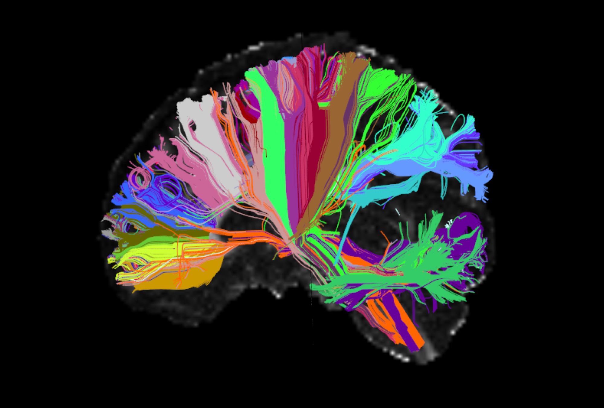 Colored brains