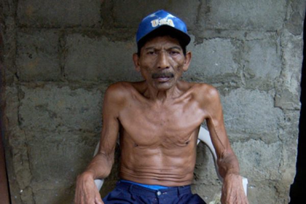 Martin Enrique Perez was rendered sterile by exposure to the pesticide DBCP while working in Nicaragua's banana fields. Photograph: Manuel Angel Esquivel Urbina.