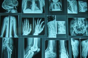 Briane-Teare-Neither-Chaos-Nor-Quest-Narrative-Medicine