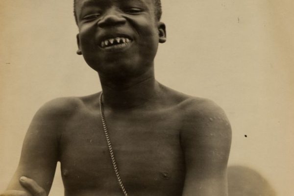 Pygmy_showing_mutilated_teeth.__Ota_Benga_Pygmy_from_Belgian_Congo_in_the_Department_of_Anthropology_at_the_1904_Worlds_Fair